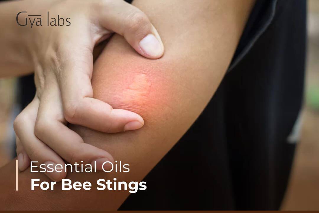 Essential Oils for Bee Stings