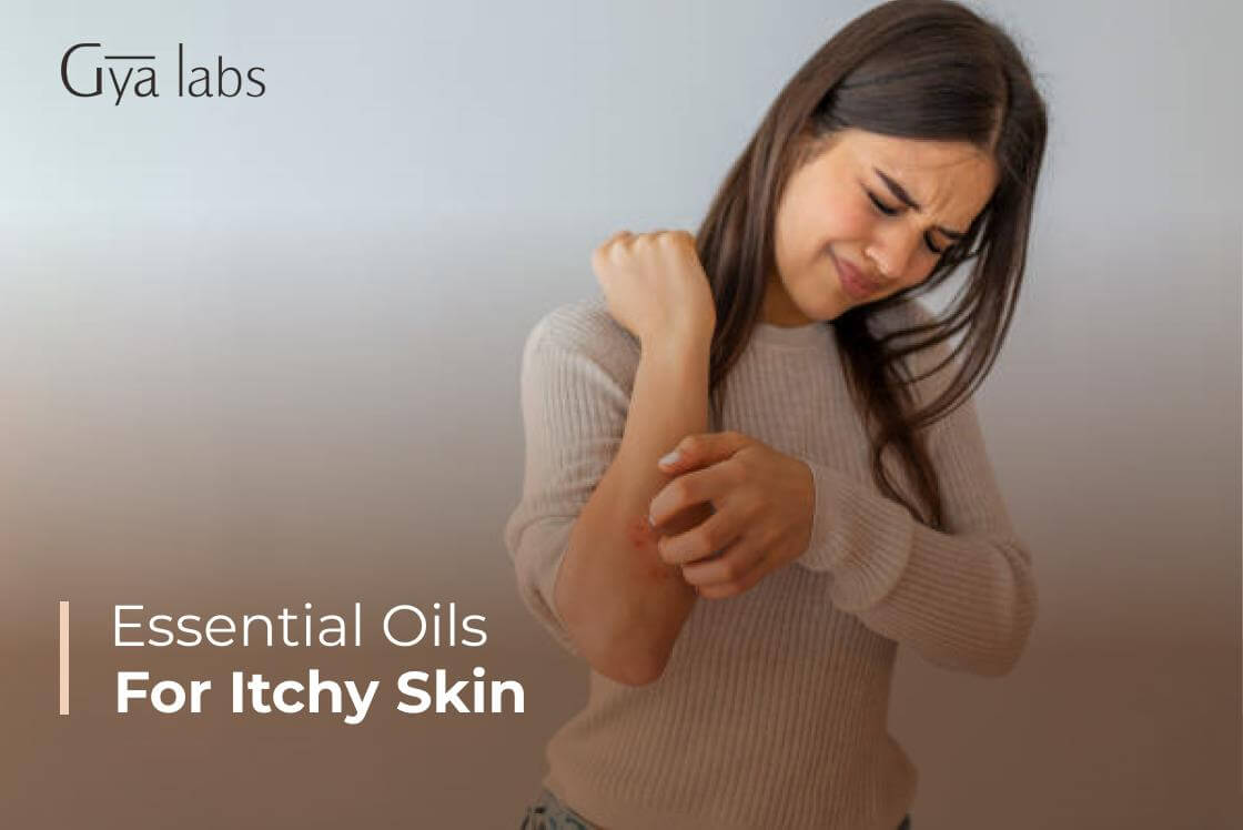 Essential Oils for itchy skin