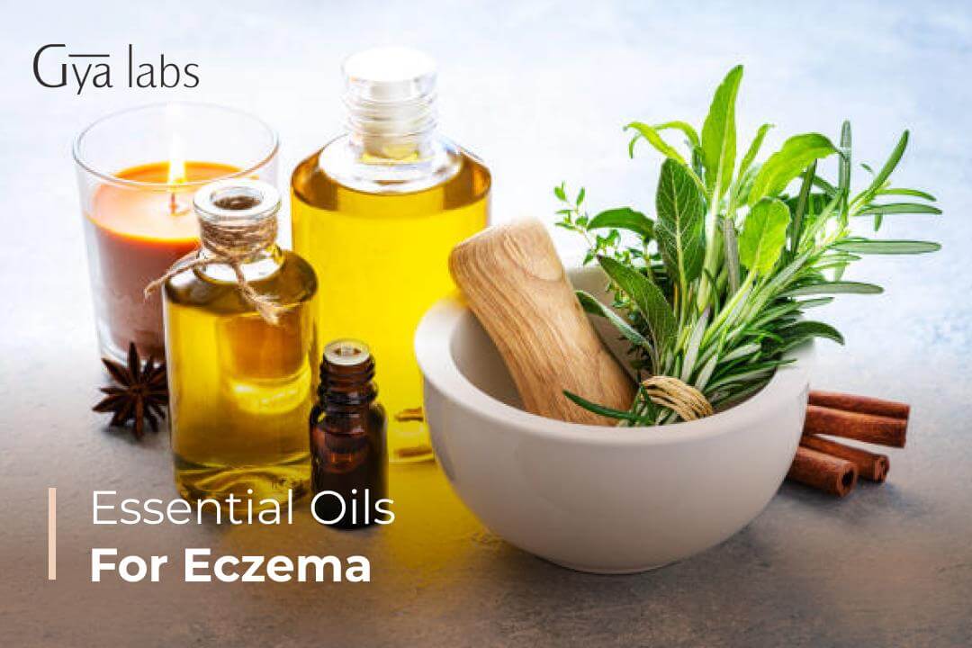essential oils for eczema