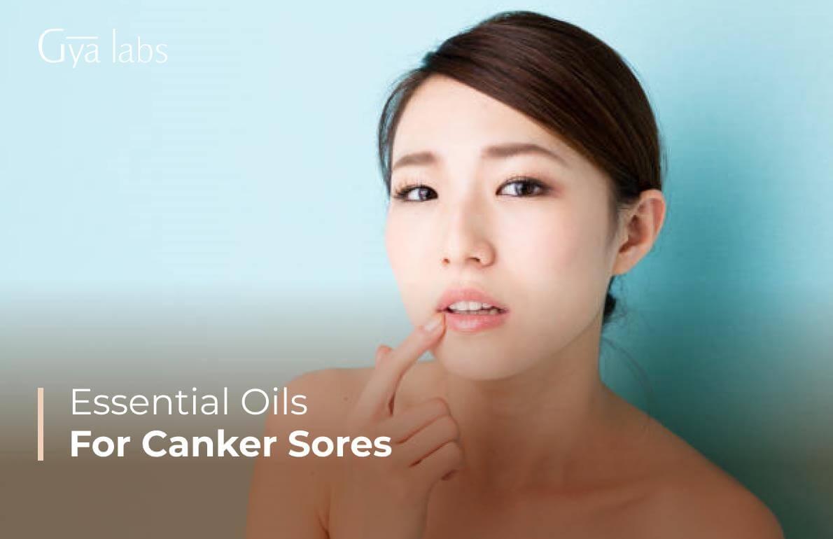essential oils for canker sores