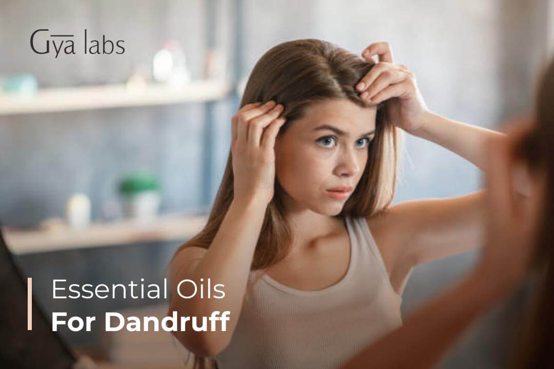 essential oils for dandruff
