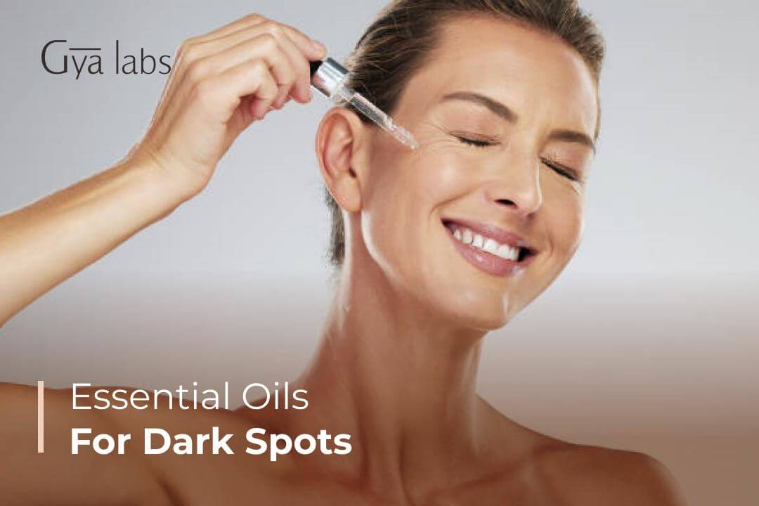 essential oils for dark spots