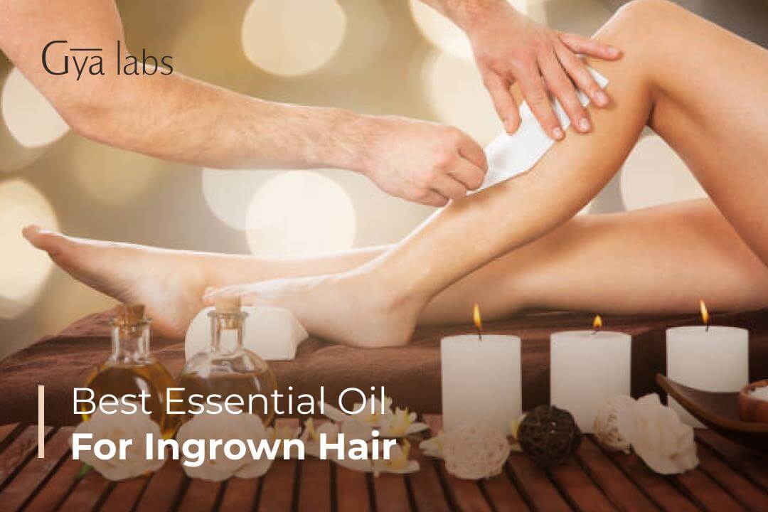 best essential oils for ingrown hair