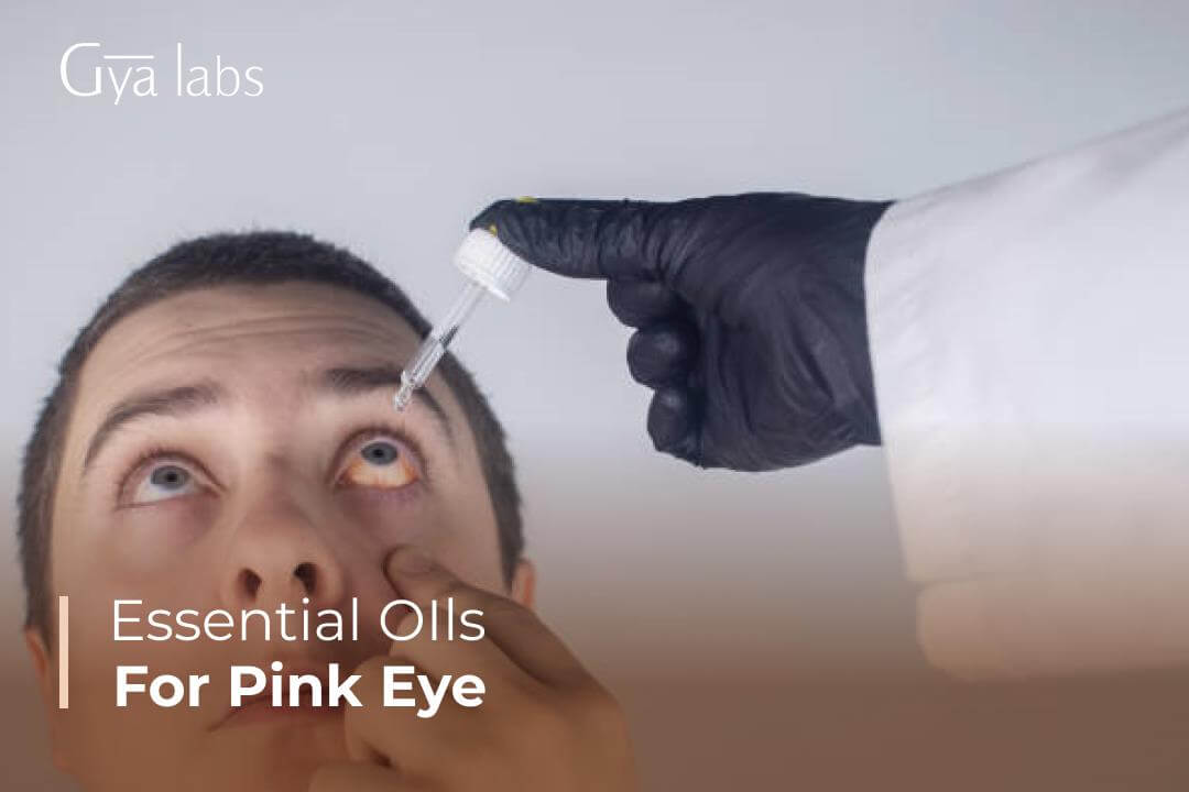 essential oils for pink eye
