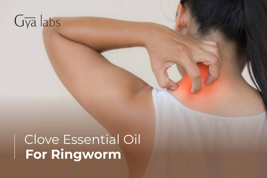 clove oil for ringworm