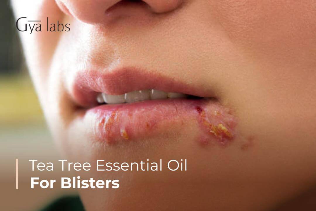 blisters on lips