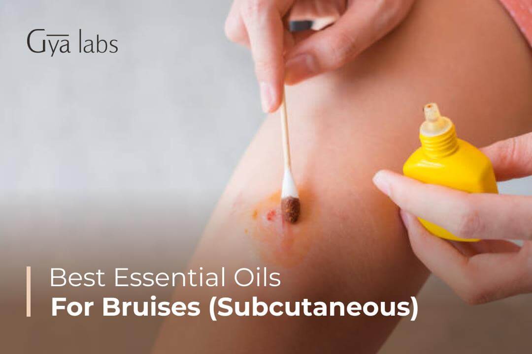 woman is applying an essential oil blend to subcutaneous bruises on her body